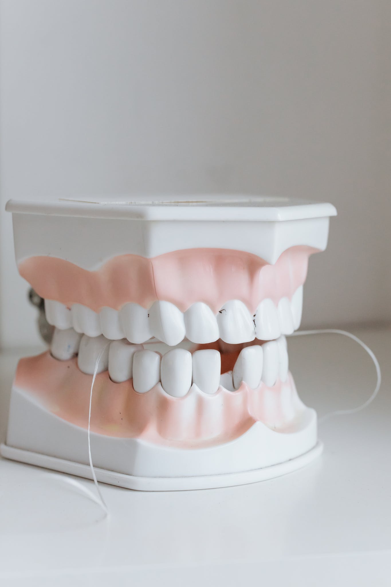 Close-Up Shot of a mouth model. Ivy Lane Dental offers teeth extractions in San Antonio, TX.